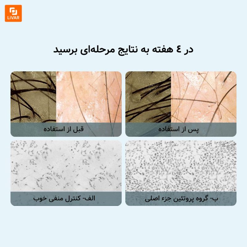 کیت تقویت‌کننده مو با پروتئین کلاژن Hemanman - Image 4