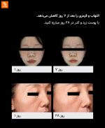 ابزار زیبایی با انرژی نوری Huazhi - Image 16