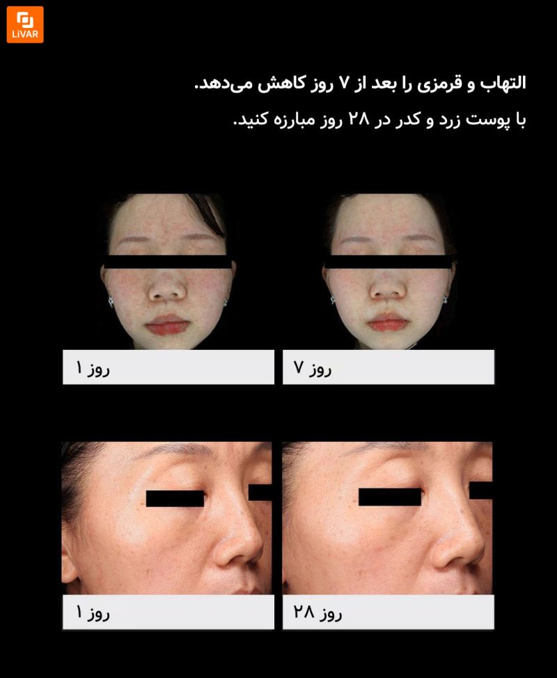 ابزار زیبایی با انرژی نوری Huazhi - Image 16