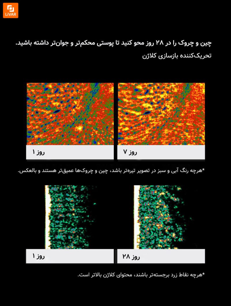 ابزار زیبایی با انرژی نوری Huazhi - Image 17
