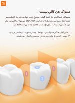 دستگاه شست‌وشوی دهان EraClean - Image 4