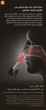 دستگاه لیزری رینیت Zuodian مدل PRO‏ - Image 11