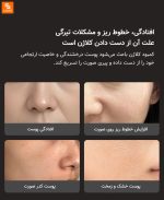 دستگاه زیبایی افزایش کلاژن DOCO - Image 9