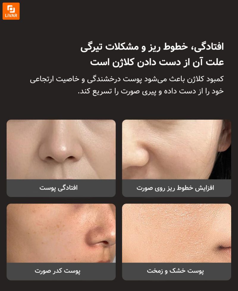 دستگاه زیبایی افزایش کلاژن DOCO - Image 9