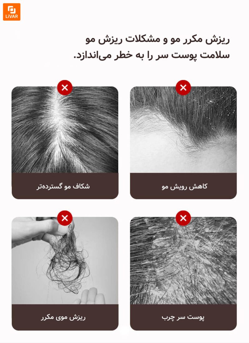 دستگاه مراقبت از پوست سر DOCO Lab - Image 11